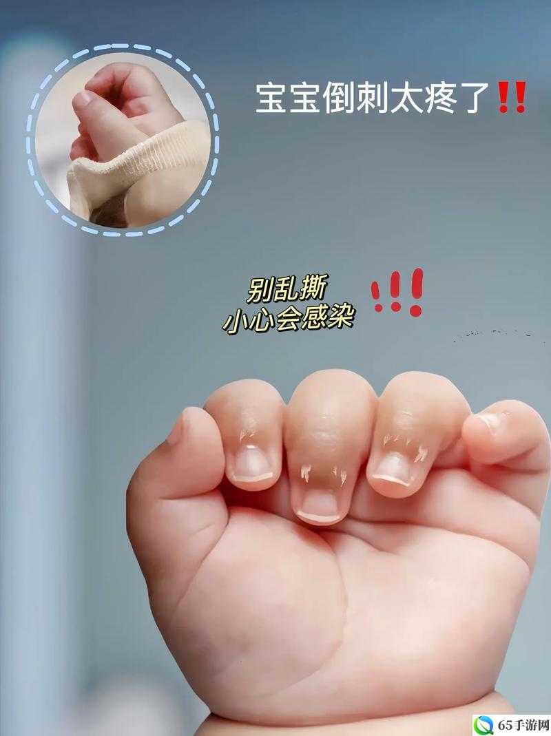 宝宝才三根手指：这么小就这么疼